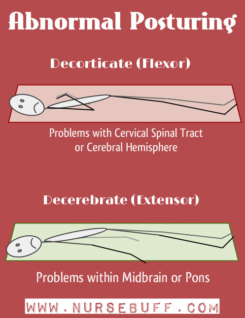 abnormal-posturing-nursing-mnemonics