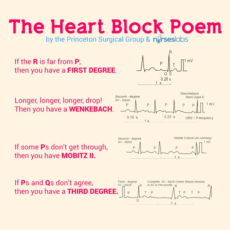 cardiac arythmias