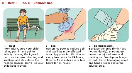 first aid for fractures