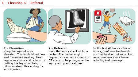 first aid for fractures